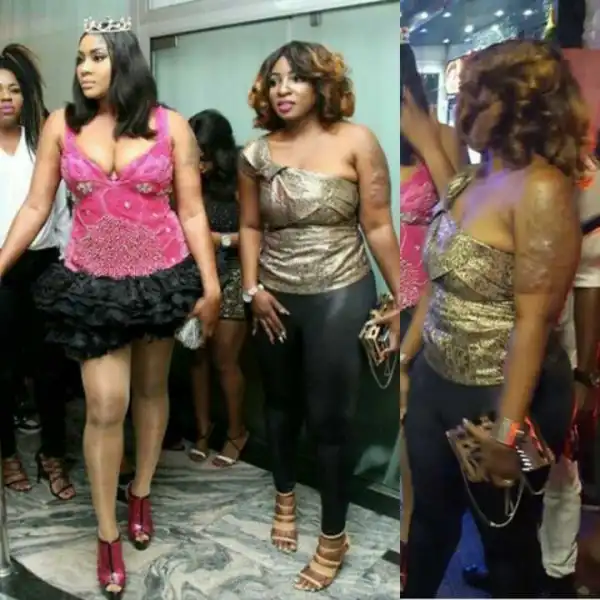 See How Tattoo Damaged The Skin Of Actress Anita Joseph